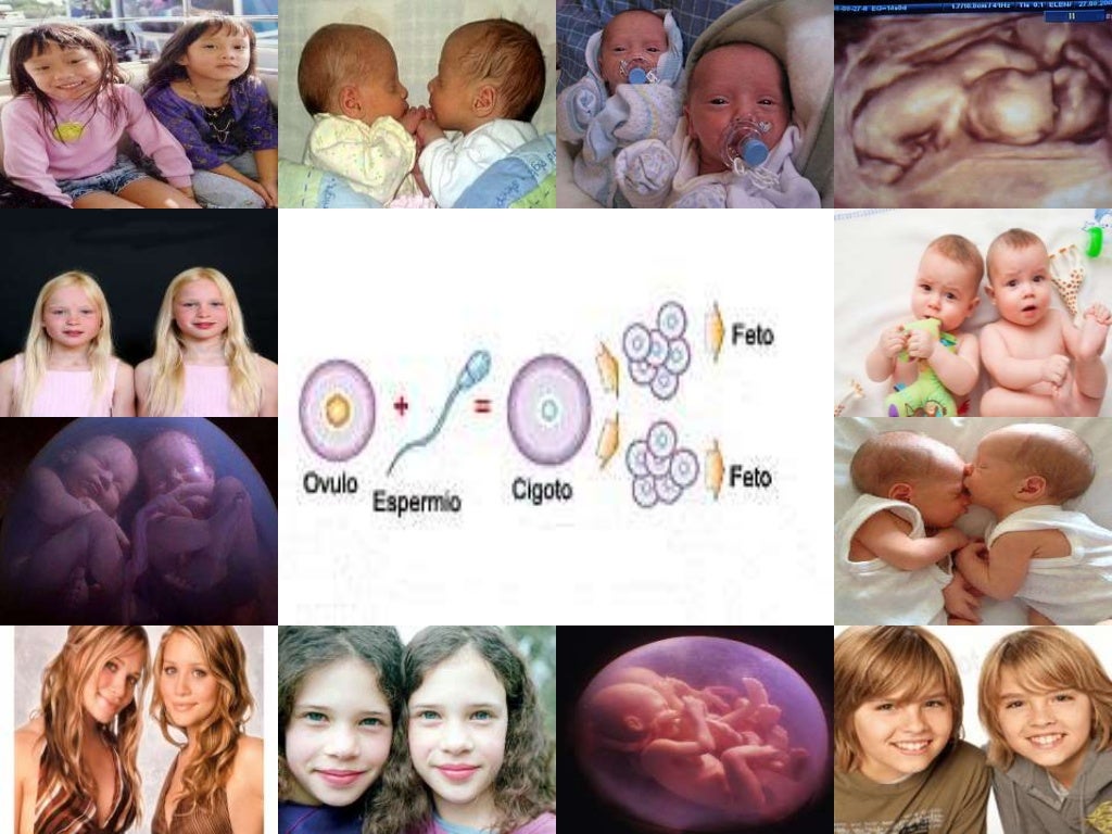 Embarazos múltiples