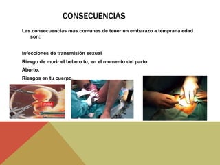 CONSECUENCIAS
Las consecuencias mas comunes de tener un embarazo a temprana edad
son:
Infecciones de transmisión sexual
Riesgo de morir el bebe o tu, en el momento del parto.
Aborto.
Riesgos en tu cuerpo.
 