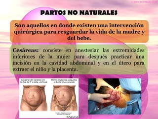 PARTOS NO NATURALES
Son aquellos en donde existen una intervención
quirúrgica para resguardar la vida de la madre y
del bebe.
Cesáreas: consiste en anestesiar las extremidades
inferiores de la mujer para después practicar una
incisión en la cavidad abdominal y en el útero para
extraer el niño y la placenta.
 