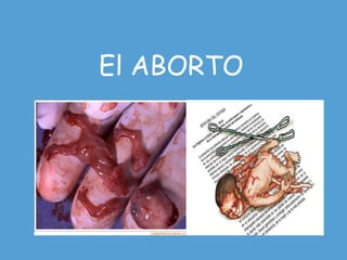 El ABORTO
 