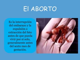 El ABORTO
Es la interrupción
del embarazo y la
expulsión o
extracción del feto
antes de que pueda
vivir por si solo,
generalmente antes
del sexto mes de
gestación.
 