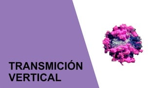 TRANSMICIÓN
VERTICAL
 