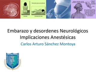 Embarazo y desordenes Neurológicos
Implicaciones Anestésicas
Carlos Arturo Sánchez Montoya
 