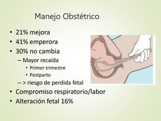 MG y Anestesia
• Valorar compromiso respiratorio
– Alteración asociada a opioides
• Técnica neuroaxial elección analgésica...
