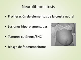 Manejo Obstétrico
• Aumento el crecimiento de las masas
• > riesgo de preeclampsia, parto pretermino,
parto instrumentado/...