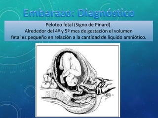 Peloteo fetal (Signo de Pinard).
Alrededor del 4º y 5º mes de gestación el volumen
fetal es pequeño en relación a la cantidad de líquido amniótico.
 