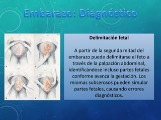 Delimitación fetal
A partir de la segunda mitad del
embarazo puede delimitarse el feto a
través de la palpación abdominal,
identificándose incluso partes fetales
conforme avanza la gestación. Los
miomas subserosos pueden simular
partes fetales, causando errores
diagnósticos.
 