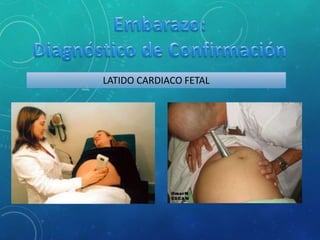 LATIDO CARDIACO FETAL
 