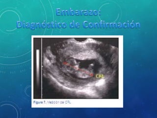 Embarazo y dx de embarazo