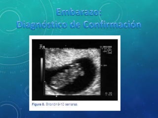 Embarazo y dx de embarazo