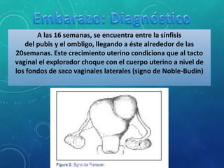 A las 16 semanas, se encuentra entre la sínfisis
del pubis y el ombligo, llegando a éste alrededor de las
20semanas. Este crecimiento uterino condiciona que al tacto
vaginal el explorador choque con el cuerpo uterino a nivel de
los fondos de saco vaginales laterales (signo de Noble-Budin)
 