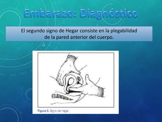 El segundo signo de Hegar consiste en la plegabilidad
de la pared anterior del cuerpo.
 