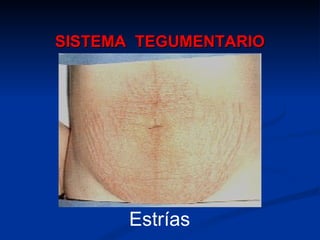 SISTEMA  TEGUMENTARIO Estrías 