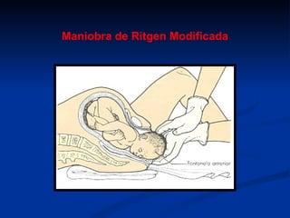 Embarazo Y Parto[1] | PPT