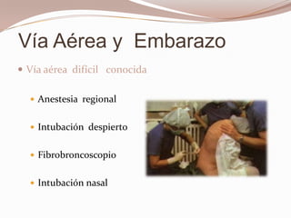 Vía aérea  difícil   conocidaAnestesia  regional Intubación  despiertoFibrobroncoscopioIntubación nasal Vía Aérea y  Embarazo 