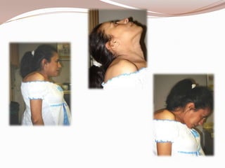 Embarazo  Y  Via  Aerea