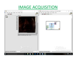 IMAGE ACQUISITION