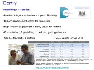Vernazza C, Ellis, J, Teasdale D, Cotterill S, Scott L, Thomason M, Drummond P, Moss J. Introduction of an 
e-portfolio in clinical dentistry: Staff and student views. Eur J Dent Education 2011;15:36-41 
Ellis JS, Teasdale D, Cotterill SJ, Thomason JM. Is a generic UK e-portfolio for dentistry desirable and 
achievable? Eur J Dent Educ 2010; 14:254-6 
iDentity 
Embedding / Integration: 
• Used on a day-to-day basis at the point of learning 
• Supports assessment across the curriculum 
• High levels of engagement & highly valued by students 
• Customisation of specialties, procedures, grading schemes 
• Used at Newcastle & partners Major update for Aug 2015 
http://www.eportfolios.ac.uk/identity 
 