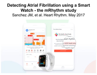 Detecting Atrial Fibrillation using a Smart
Watch - the mRhythm study
Sanchez JM, et al. Heart Rhythm. May 2017
 