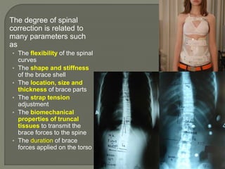 The degree of spinal
correction is related to
many parameters such
as
• The flexibility of the spinal
curves
• The shape and stiffness
of the brace shell
• The location, size and
thickness of brace parts
• The strap tension
adjustment
• The biomechanical
properties of truncal
tissues to transmit the
brace forces to the spine
• The duration of brace
forces applied on the torso
 