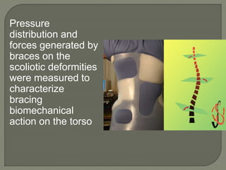 Pressure
distribution and
forces generated by
braces on the
scoliotic deformities
were measured to
characterize
bracing
biomechanical
action on the torso
 