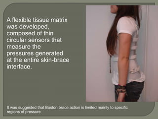 A flexible tissue matrix
was developed,
composed of thin
circular sensors that
measure the
pressures generated
at the entire skin-brace
interface.
It was suggested that Boston brace action is limited mainly to specific
regions of pressure
 