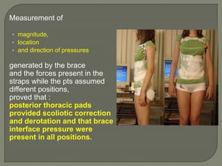 Measurement of
• magnitude,
• location
• and direction of pressures
generated by the brace
and the forces present in the
straps while the pts assumed
different positions,
proved that :
posterior thoracic pads
provided scoliotic correction
and derotation and that brace
interface pressure were
present in all positions.
 