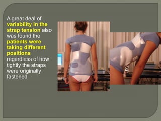 A great deal of
variability in the
strap tension also
was found the
patients were
taking different
positions
regardless of how
tightly the straps
were originally
fastened
 