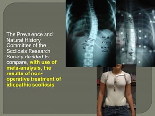The Prevalence and
Natural History
Committee of the
Scoliosis Research
Society decided to
compare, with use of
meta-analysis, the
results of non-
operative treatment of
idiopathic scoliosis
 