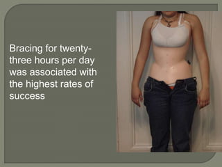 Bracing for twenty-
three hours per day
was associated with
the highest rates of
success
 