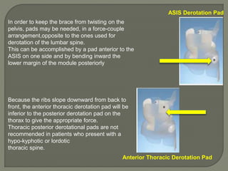 ASIS Derotation Pad
Because the ribs slope downward from back to
front, the anterior thoracic derotation pad will be
inferior to the posterior derotation pad on the
thorax to give the appropriate force.
Thoracic posterior derotational pads are not
recommended in patients who present with a
hypo-kyphotic or lordotic
thoracic spine.
Anterior Thoracic Derotation Pad
In order to keep the brace from twisting on the
pelvis, pads may be needed, in a force-couple
arrangement,opposite to the ones used for
derotation of the lumbar spine.
This can be accomplished by a pad anterior to the
ASIS on one side and by bending inward the
lower margin of the module posteriorly
 