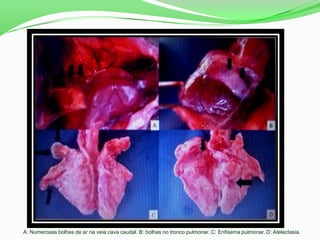 A: Numerosas bolhas de ar na veia cava caudal. B: bolhas no tronco pulmonar. C: Enfisema pulmonar. D: Atelectasia.
 