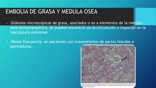 EMBOLIA DE GRASA Y MEDULA OSEA
• Glóbulos microscópicos de grasa, asociados o no a elementos de la médula
ósea hematopoyética, se pueden encontrar en la circulación e impactar en la
vasculatura pulmonar.
• Menos frecuencia, en pacientes con traumatismos de partes blandas o
quemaduras.
 