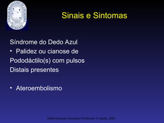 Sinais e Sintomas
Síndrome do Dedo Azul
• Palidez ou cianose de
Pododáctilo(s) com pulsos
Distais presentes
• Ateroembolismo
Maffei-Doenças Vasculares Periféricas- 3º edição, 2002
 