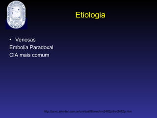 Etiologia
• Venosas
Embolia Paradoxal
CIA mais comum
http://pcvc.sminter.com.ar/cvirtual/tlibres/tnn2482p/tnn2482p.htm
 