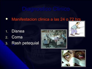 DDiiaaggnnoossttiiccoo CClliinniiccoo 
 MMaanniiffeessttaacciioonn cclliinniiccaa aa llaass 2244 oo 7722 hhrrss 
11.. DDiissnneeaa 
22.. CCoommaa 
33.. RRaasshh ppeetteeqquuiiaall 
 