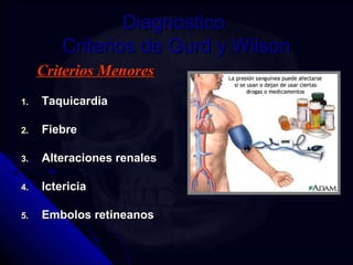 DDiiaaggnnoossttiiccoo 
CCrriitteerriiooss ddee GGuurrdd yy WWiillssoonn 
CCrriitteerriiooss MMeennoorreess 
11.. TTaaqquuiiccaarrddiiaa 
22.. FFiieebbrree 
33.. AAlltteerraacciioonneess rreennaalleess 
44.. IIcctteerriicciiaa 
55.. EEmmbboollooss rreettiinneeaannooss 
 