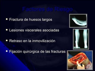 FFaaccttoorreess ddee RRiieessggoo 
 FFrraaccttuurraa ddee hhuueessooss llaarrggooss 
 LLeessiioonneess vviisscceerraalleess aassoocciiaaddaass 
 RReettrraassoo eenn llaa iinnmmoovviilliizzaacciióónn 
 FFiijjaacciióónn qquuiirrúúrrggiiccaa ddee llaass ffrraaccttuurraass 
 