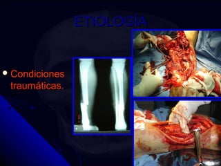 EETTIIOOLLOOGGÍÍAA 
CCoonnddiicciioonneess 
ttrraauummááttiiccaass. 
 