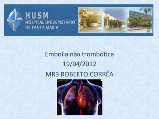 Embolia não trombótica
     19/04/2012
MR3 ROBERTO CORRÊA
 