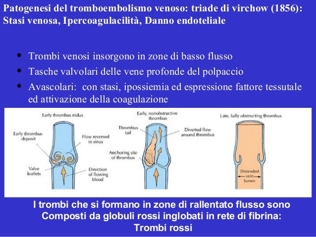 Varicosity di un piccolo forum di risposte di trattamento di pelvi