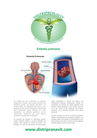 www.distripronavit.com
Embolia pulmonar
Un émbolo es, por lo general, un coágulo
sanguíneo (trombo), pero puede también ser
émbolos grasos, de líquido amniótico, de
médula ósea, un fragmento de tumor o una
burbuja de aire que se desplaza a través del
flujo sanguíneo hasta obstruir un vaso
sanguíneo. La embolia pulmonar es la
obstrucción repentina de una arteria
pulmonar causada por un émbolo.
En general, las arterias no obstruidas pueden
enviar suficiente sangre a la zona afectada del
pulmón para impedir la muerte del tejido. Sin
embargo, en caso de obstrucción de los grandes
vasos sanguíneos o cuando se padece una
enfermedad pulmonar preexistente, puede ser
insuficiente el volumen de sangre aportado para
evitar la muerte del tejido, lo que puede ocurrir en
el 10 por ciento de las personas con embolia
pulmonar; es la situación conocida como infarto
pulmonar.
El daño se reduce al mínimo cuando el organismo
deshace rápidamente los pequeños coágulos. Los
grandes tardan más tiempo en desintegrarse y por
tanto la lesión será mayor. De ahí que los coágulos
grandes puedan causar muerte súbita.
 