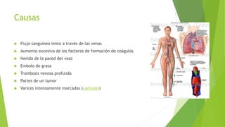 Causas 
 Flujo sanguíneo lento a través de las venas 
 Aumento excesivo de los factores de formación de coágulos 
 Herida de la pared del vaso 
 Embolo de grasa 
 Trombosis venosa profunda 
 Partes de un tumor 
 Varices intensamente marcadas (varicosis) 
 