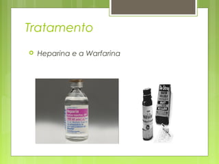 Tratamento
 Heparina e a Warfarina
 