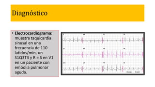 Diagnóstico
• Electrocardiograma:
muestra taquicardia
sinusal en una
frecuencia de 110
latidos/min, un
S1Q3T3 y R = S en V1
en un paciente con
embolia pulmonar
aguda.
 