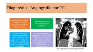 Diagnóstico. Angiografía por TC
Es la técnica de imagen
preferida para el
diagnóstico de embolia
pulmonar aguda.
Es rápida, precisa y
altamente sensible y
específica.
El tiempo rápido de la
exploración permite el
uso de volúmenes más
pequeños de medios de
contraste yodados, lo que
reduce el riesgo de lesión
renal aguda.
La sensibilidad de la
angiografía por TC es más
alta para la embolia
pulmonar en la arteria
pulmonar principal y los
vasos lobulares y
segmentarios.
https://www.msdmanuals.com/es-mx/professional/trastornos-
pulmonares/embolia-pulmonar-ep/embolia-pulmonar-ep
 