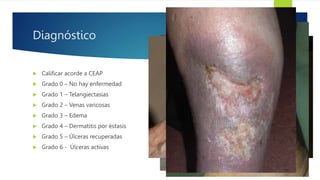 Trombosis Venosa Profunda y Embolia pulmonar.pptx
