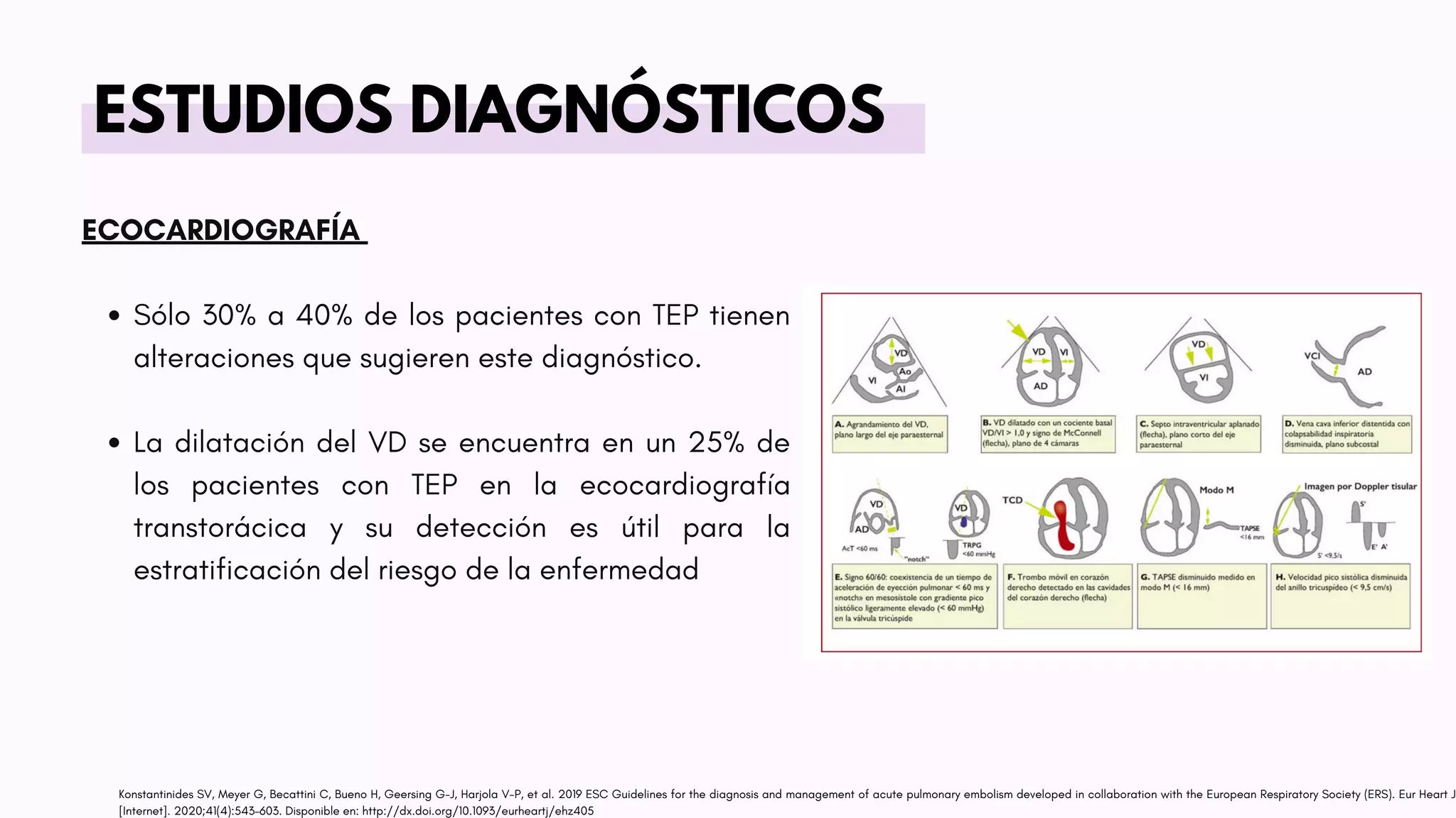 ESTUDIOS DIAGNÓSTICOS
Sólo 30% a 40% de los pacientes con TEP tienen
alteraciones que sugieren este diagnóstico.
La dilatación del VD se encuentra en un 25% de
los pacientes con TEP en la ecocardiografía
transtorácica y su detección es útil para la
estratificación del riesgo de la enfermedad
ECOCARDIOGRAFÍA
Konstantinides SV, Meyer G, Becattini C, Bueno H, Geersing G-J, Harjola V-P, et al. 2019 ESC Guidelines for the diagnosis and management of acute pulmonary embolism developed in collaboration with the European Respiratory Society (ERS). Eur Heart J
[Internet]. 2020;41(4):543–603. Disponible en: http://dx.doi.org/10.1093/eurheartj/ehz405
 