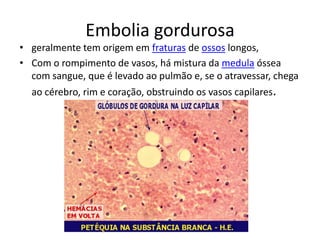 Embolia gordurosa
• geralmente tem origem em fraturas de ossos longos,
• Com o rompimento de vasos, há mistura da medula óssea
com sangue, que é levado ao pulmão e, se o atravessar, chega
ao cérebro, rim e coração, obstruindo os vasos capilares.
 