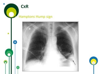 Embolic and thromboembolic diseases | PPTX